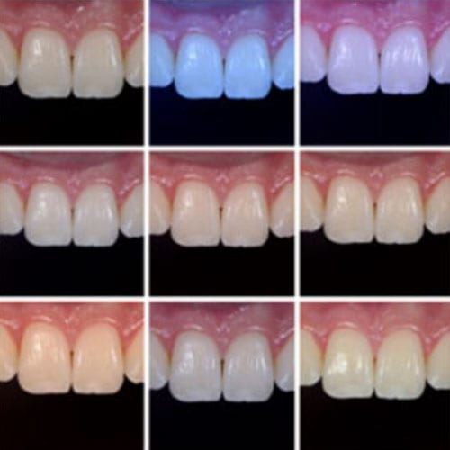 White Balance – the Unsung Hero in Dental Photography